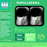 Papilledema