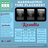 Nasogastric Tube Placement