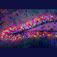 WiTdaily 004 – ตกลงสมองเราสร้างเซลใหม่ได้หรือไม่? คุยงานวิจัยใหม่ล่าสุดกับน้องเฌอปรางตัวปลอม