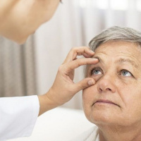 Cataratas y glaucoma