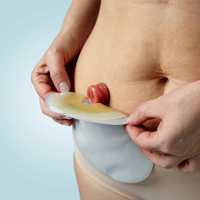 ¿Qué son las heridas y ostomías?