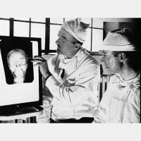 Walter Freeman, and the Lobotomy