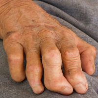 Mundo solidario - Proyectos de cooperación de la Fundación Fontilles - 24/08/25