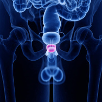 Prostata-Krebs: Deshalb brauchen wir eine andere Früherkennung