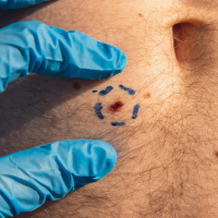 Mustererkennung bei Krebs: KI bringt Tumordiagnostik voran