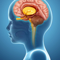 Schlaganfall bei Kindern – So unterstützen Selbsthilfevereine