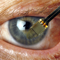 Blindheit: Welche Therapieansätze gibt es heute?