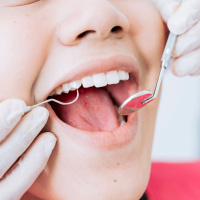 Wegen Corona: Deutlich weniger Termine bei der Zahnvorsorge