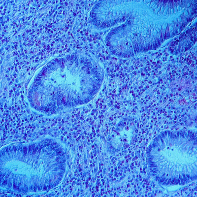Swr2 Impuls - Wissen Aktuell