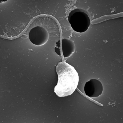 Swr2 Impuls - Wissen Aktuell