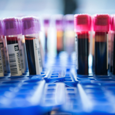 Swr2 Impuls - Wissen Aktuell