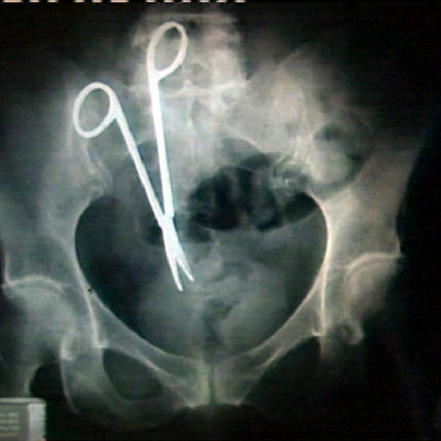 Swr2 Impuls - Wissen Aktuell