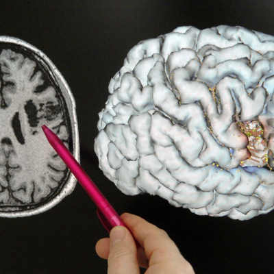 Swr2 Impuls - Wissen Aktuell