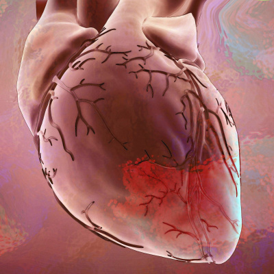 Swr2 Impuls - Wissen Aktuell