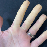 Pod Pick: Learning About Raynauds Disease