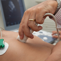 O que é o ecocardiograma transtorácico bidimensional com doppler?