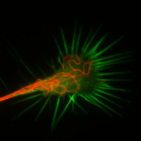 Part 2 T-1 Brain  How PTSD Can Heal