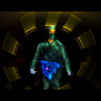 Does what I eat affect my IBD (Crohns or UC)?