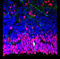 The Power in Your Fat - DrG talks with Dr. Tami Meralia about stem cell therapy