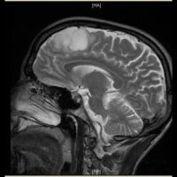 Playback: My Head Is Killing Me