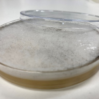 Fungal pandemic threat