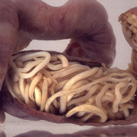 We have huge worms in our Guts?? No thanks!