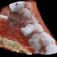 Большой Коллайдер помог раскрасить рентген