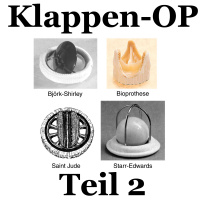 Klappen-OP (2)