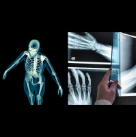 The Icky Truth About Our Bones