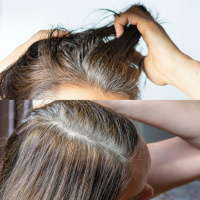 Is It Possible To Stop Those Greys?