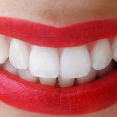 Projeto Promontório