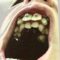 The Wall- it’s coming ...Sleeping Giants?