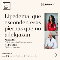Lipedema: qué esconden esas piernas que no adelgazan, con Ángela Río y Rodrigo Rial. Episodio 217