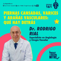 Piernas cansadas, varices y arañas vasculares: qué hay detrás, con el Dr. Rodrigo Rial. Episodio 161.