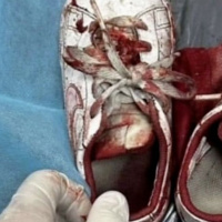 Letting The Cruelty Of The World Break Our Hearts Together