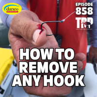 How to Remove ANY Hook! | H2T | Episode #858