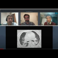 Aspectos histológicos da COVID-19 - Correlação radiológica com autópsia minimamente invasiva