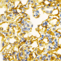 How Mitochondria Inform Disease Discoveries with Navdeep Chandel, PhD