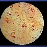 What is the difference between Typhoid and Typhus?