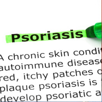 Expert advice on the skin condition of Psoriasis