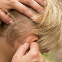 How to deal with an head lice infestation!