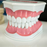 How to get your pearly whites ready for the wedding