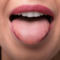 Diagnosing diseases by examining the tongue