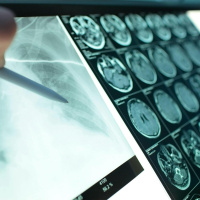 Why can’t we offer MRIs and ultrasounds in hospital 24/7?