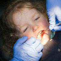 Schoolchildren are losing out on vital dental screenings 
