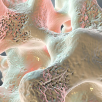 Osteoporosis campaign called ‘Unbreakable’