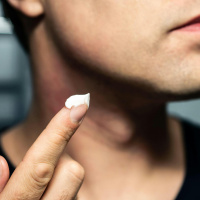 The causes and treatments of acne