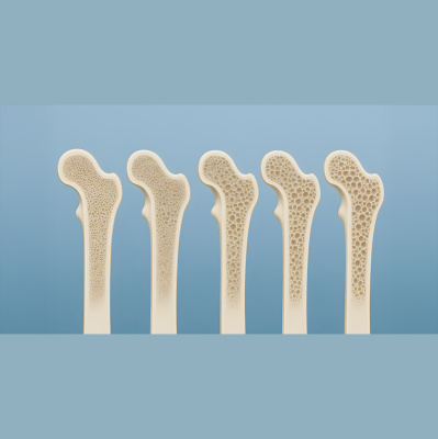 Obiettivo Salute - Risveglio