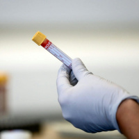 Cancer care delays causing serious concern