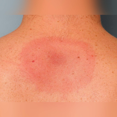 Highlights From Lunchtime Live